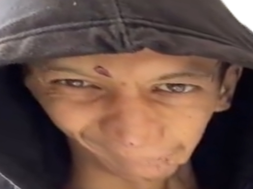 lol